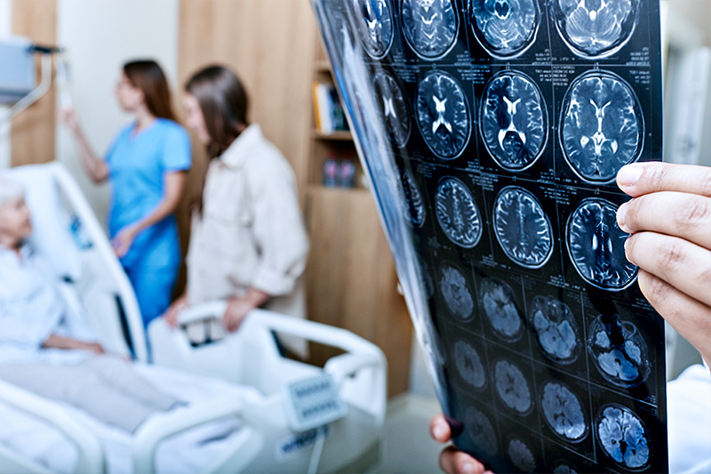 Learn BEFAST and save a life